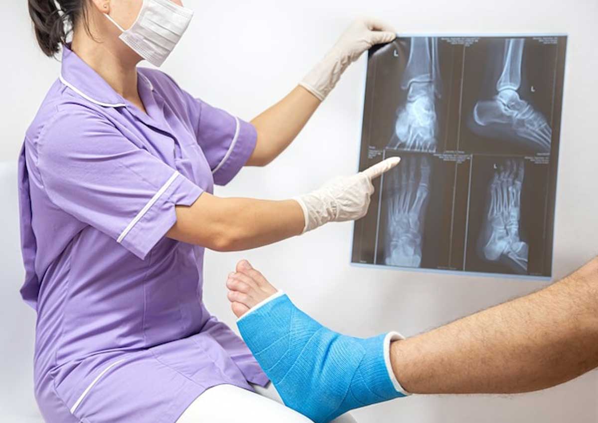 Treatment for Broken Bones